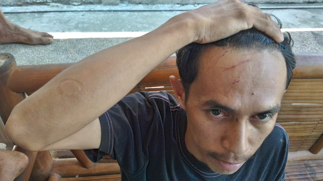 STRAFED AND GRAZED Aladen Rosquitos shows the scratches on the top of his head, after crawling far to evade the hour-long strafing of the military to their house. He says that elements of the 60th IB strafed his home. In the last days of Oplan Bayanihan, state violence rages on. 